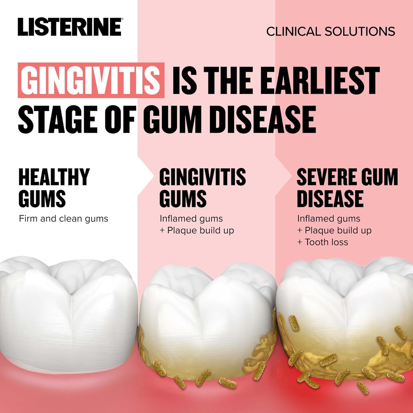 Listerine Clinical Solutions Gum Health Antiseptic Mouthwash, Antigingivitis & Antiplaque Oral Rinse Kills Germs for Healthier Gums, Reduces Gingivitis in 1 Week, ICY Mint, Twin Pack, 1 L, 2 Pack