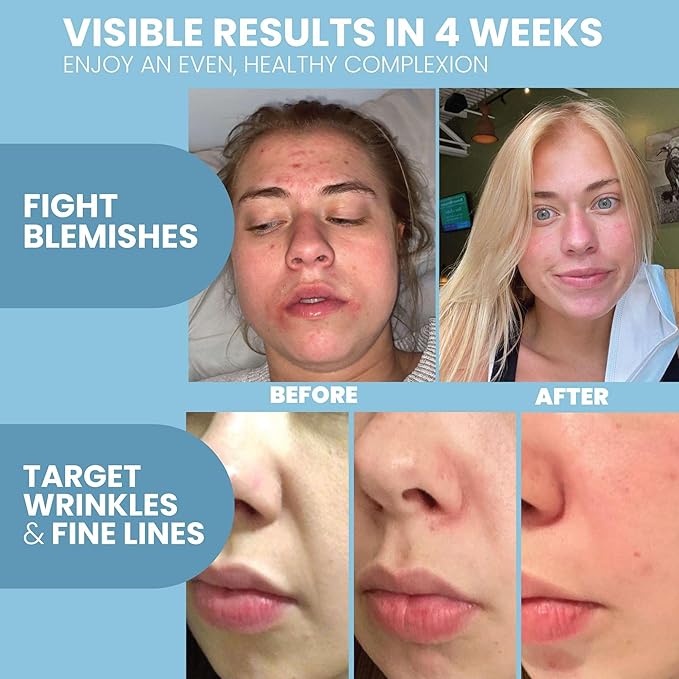 Eva Naturals Retinol Serum for Face – Anti Aging Night Serum with Hyaluronic Acid, Vitamin E, Witch Hazel, Aloe – Wrinkle Moisturizer, Dark Spot Care, Post-Blemish Mark Care, Skin Brightening – 2oz