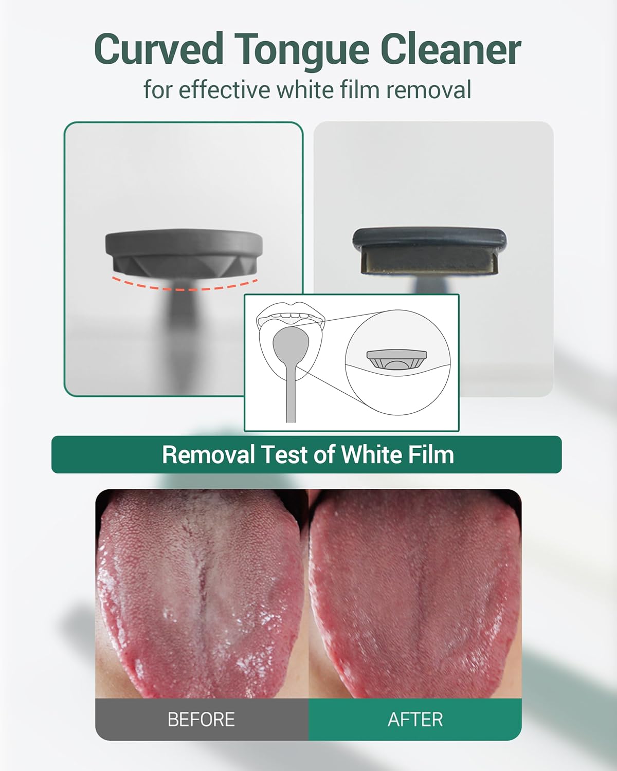 DEARCUS Korean Tongue Scraper with 3 Replaceable Heads - 100% BPA Free TPE Tongue Cleaner - Reduce Bad Breath & Without Hurt - Hygienic Scraper - Modern & Simple Design (Deep Gray)