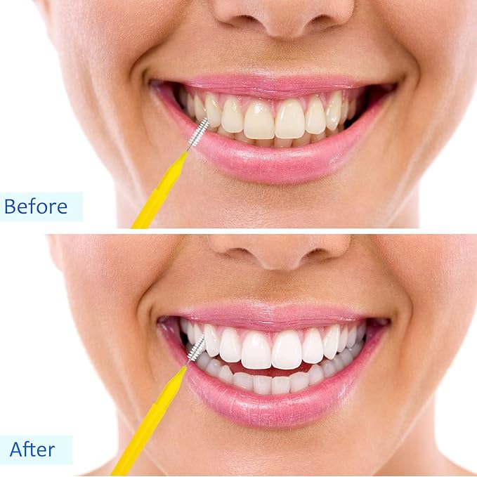 Patelai 100 Pieces Braces Brush for Cleaner Interdental Brush Toothpick Dental Tooth Flossing Head Oral Dental Hygiene Flosser Toothpick Cleaners Tooth Cleaning Tool(Delicate Colors,Plenty Sizes)