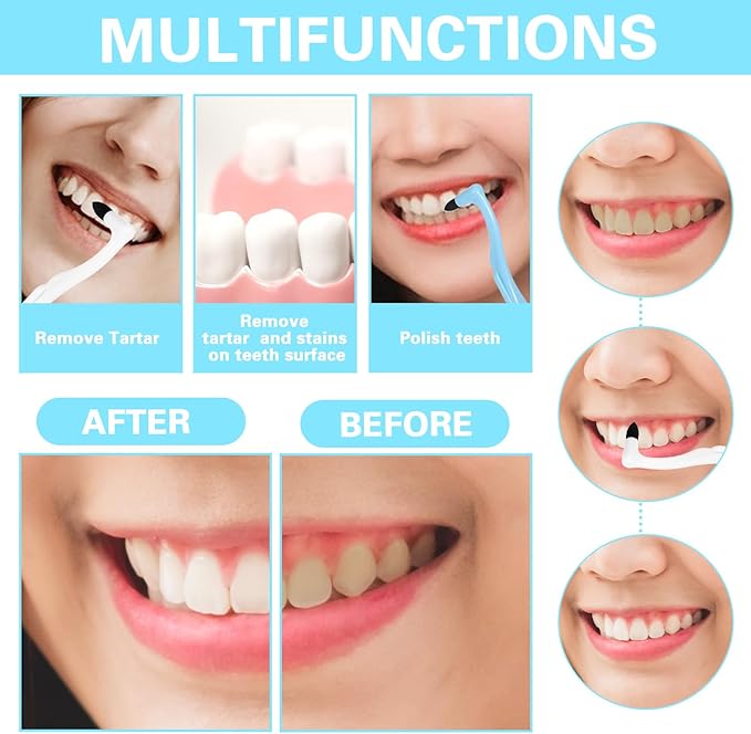 Tooth Stain Eraser Dental Tooth Stain Eraser Removers Teeth Scraper Dental Plaque Tartar Erasers Polisher Professional Dentals Picks Brush Teeth Polisher for Adult Oral Care