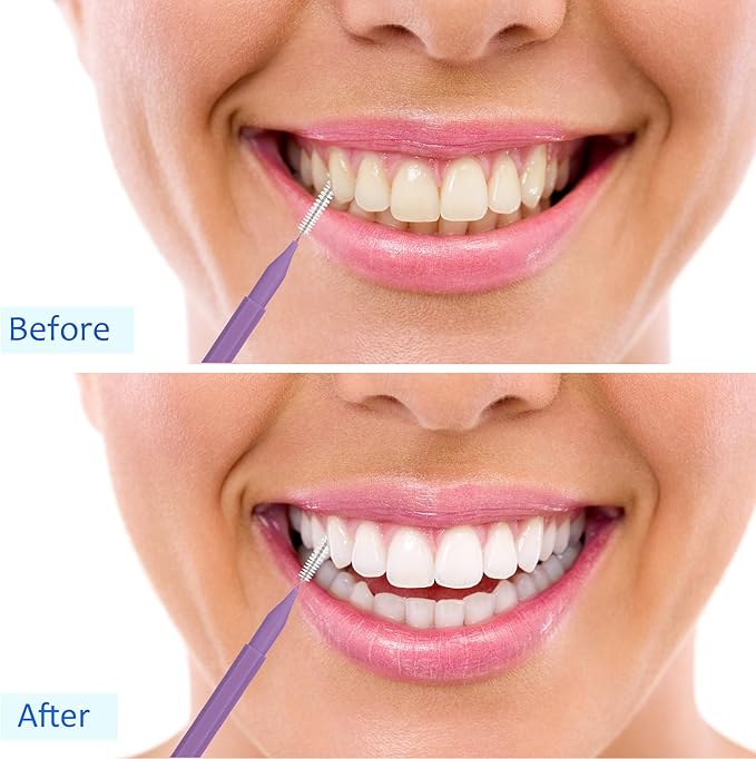 Patelai 100 Pieces Braces Brush for Cleaner Interdental Brush Toothpick Dental Tooth Flossing Head Oral Dental Hygiene Flosser Toothpick Cleaners Tooth Tool (Pink,Purple,Suitable Size)