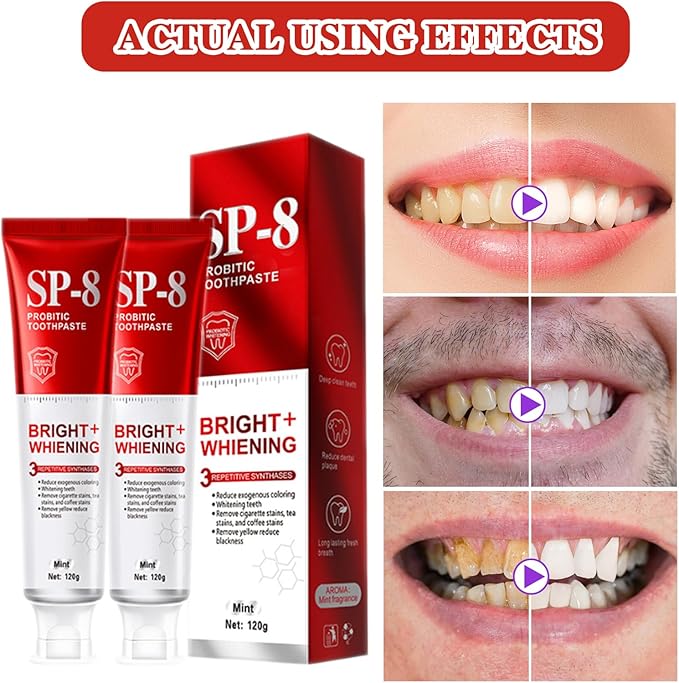 2PCS SP-8 Toothpaste, SP-8 Probiotic Whitening Toothpaste, for Fresh Breath, Protects Teeth & Oral Health, Rich Foam & Easy Rinse, Deep Cleaning Care