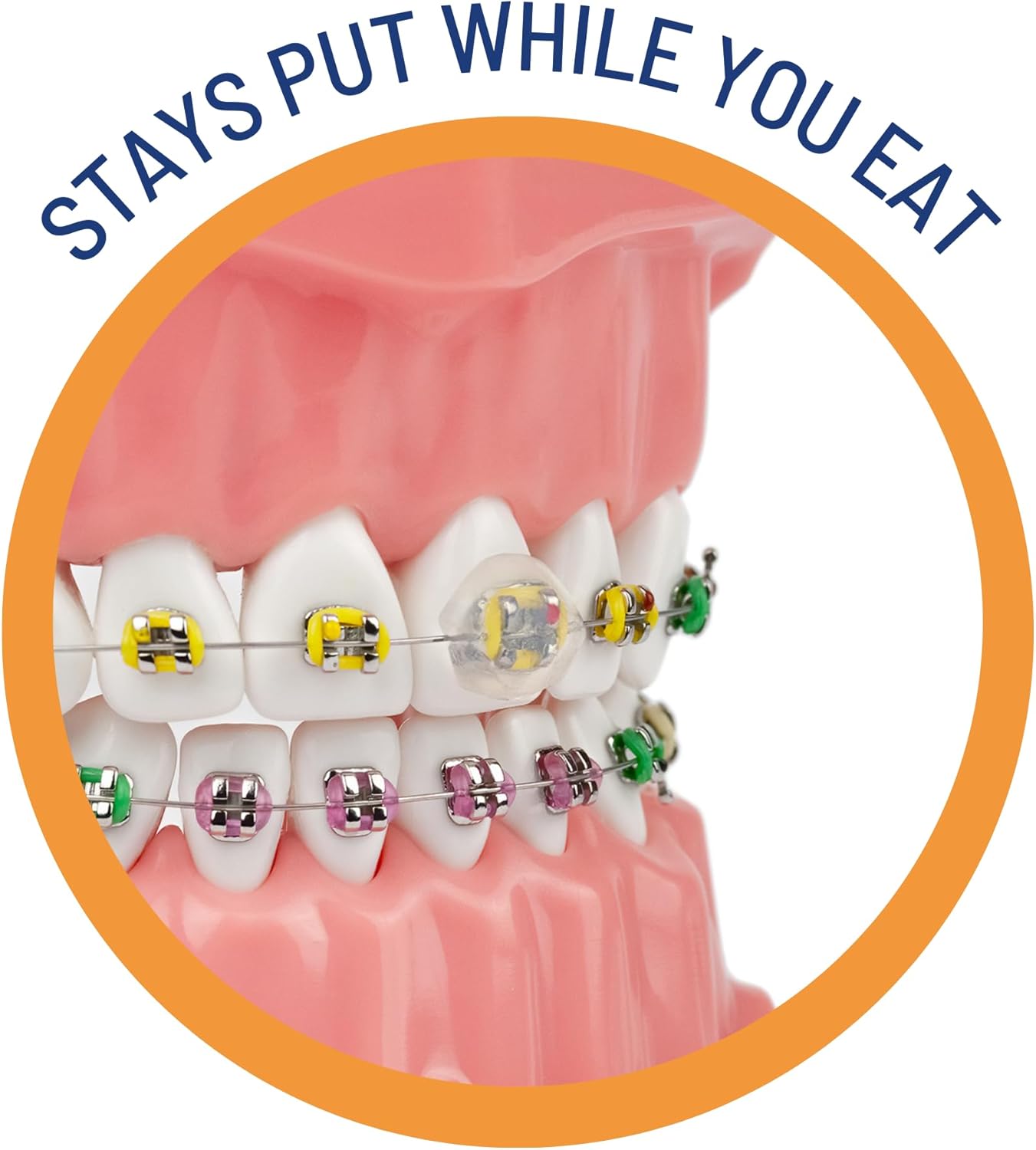 OrthoDots Clear – 24-Hour Protection | Sticks Better Than Dental Wax | Moisture Activated Braces Wax Alternative for Pain Caused by Braces, Clear Aligner Trays, and Other Orthodontic Appliances