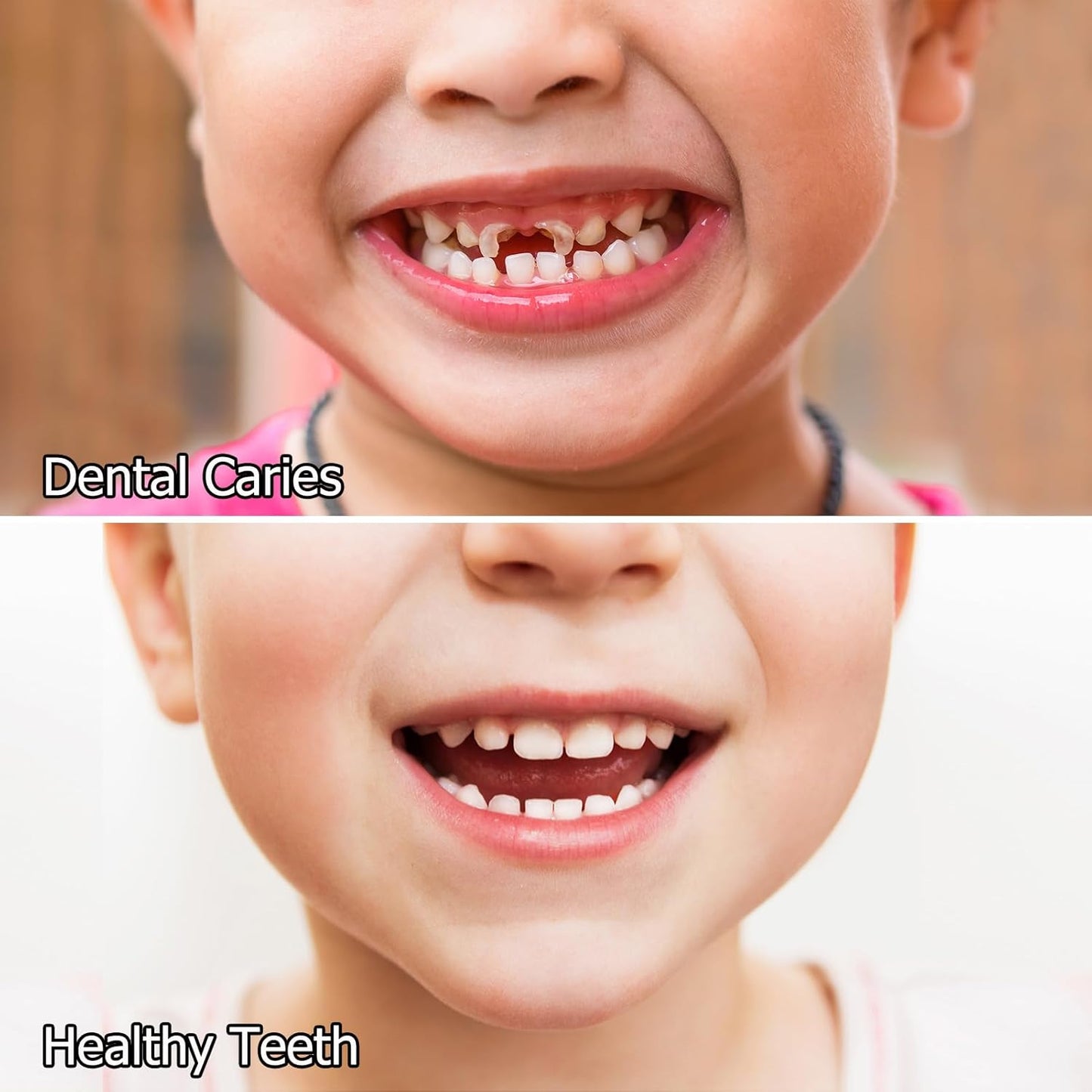 Kids Oral Spray, Toddler Toothpaste Helper for Cavity Prevention and Fresh Breath, Children Anticavity with Fluoride Free for Newborn to Preschoolers, Kid's Mouth Spray (1)