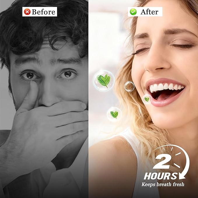 Breath Spray for Fresh Breath, Probiotic Oral Spray for Dry Mouth Relief and Everyday Freshness, Mint Mouth Spray with Gentle Moisturizing Formula, Alcohol-Free Travel Size Oral Care, 20ml (1PC)