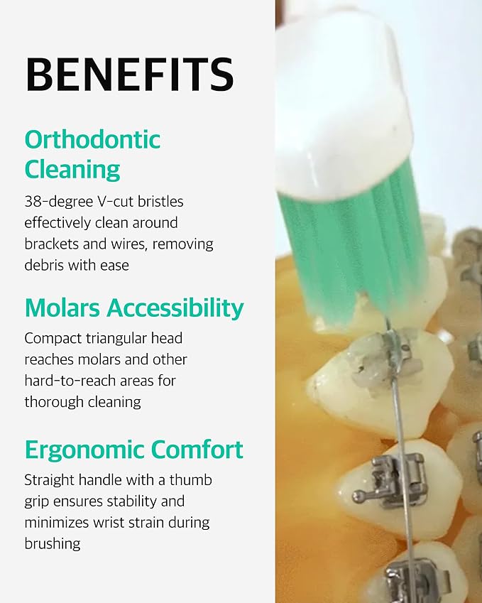 V-Cut Orthodontic Toothbrush(White) - Compact Head for Braces, Ergonomic Handle, Deep Cleaning, Gentle Bristles for Brackets and Wires