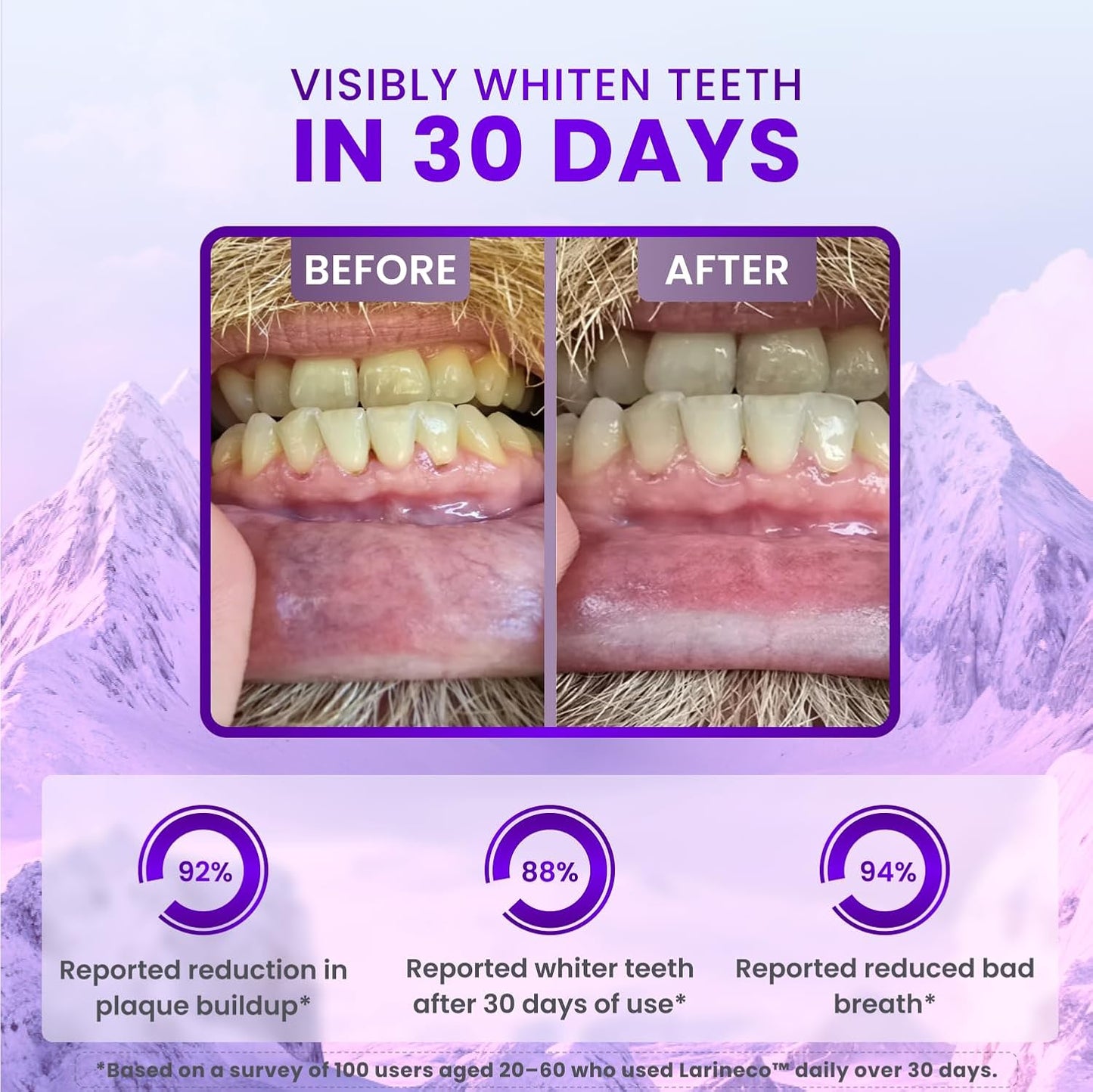 Larineco Remineralizing Gum with Nano Hydroxyapatite & Xylitol – Sugar-Free Cinnamon Xylitol Gum – Plastic-Free, Dye-Free, Aspartame-Free – Natural Base – 18 Pieces (18 Count (Pack of 2), Berry)