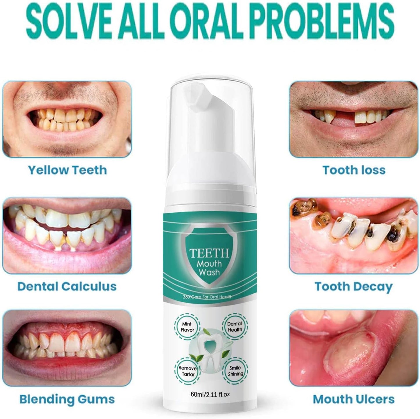 Teeth Total Care Mouthwash, Ultra-Fine Herbal Foam, Mint Taste, Repairs Teeth & Gums, Refreshes Breath, Solves Oral Problems (1pc) 60ml