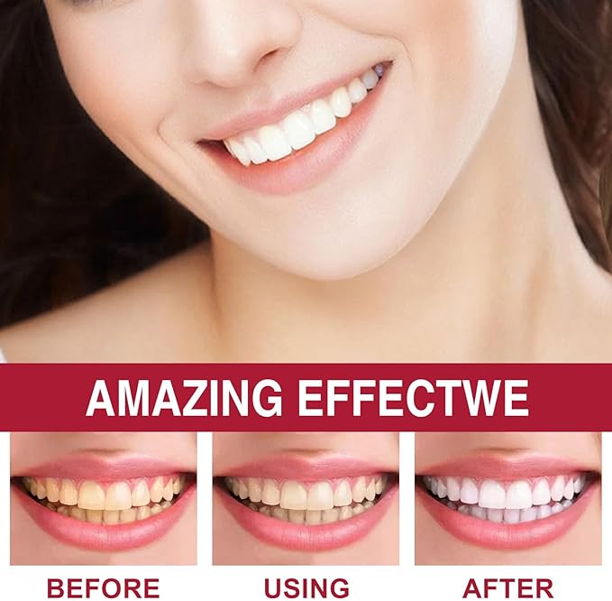 SP-6 Probiotics Whitening Toothpaste, with Probiotics Deep Cleaning Oral Care Removing Teeth Stain & Retain Fresh Breath.