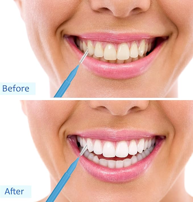 Patelai 100 Pieces Braces Brush for Cleaner Interdental Brush Toothpick Dental Tooth Flossing Head Oral Dental Hygiene Flosser Toothpick Cleaners Tooth Cleaning Tool(Blue, Grey,Mixed Sizes)