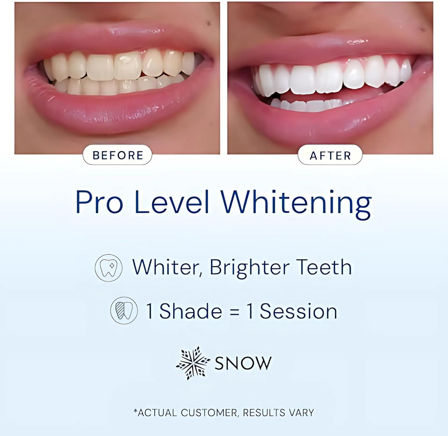 Snow Teeth Whitening Kit - Snow Teeth Whitening Serum and LED Mouthpiece Whitener, Formulated with Hydroxyapatite, Good for 2 Months - Wireless Kit with 1 Wand