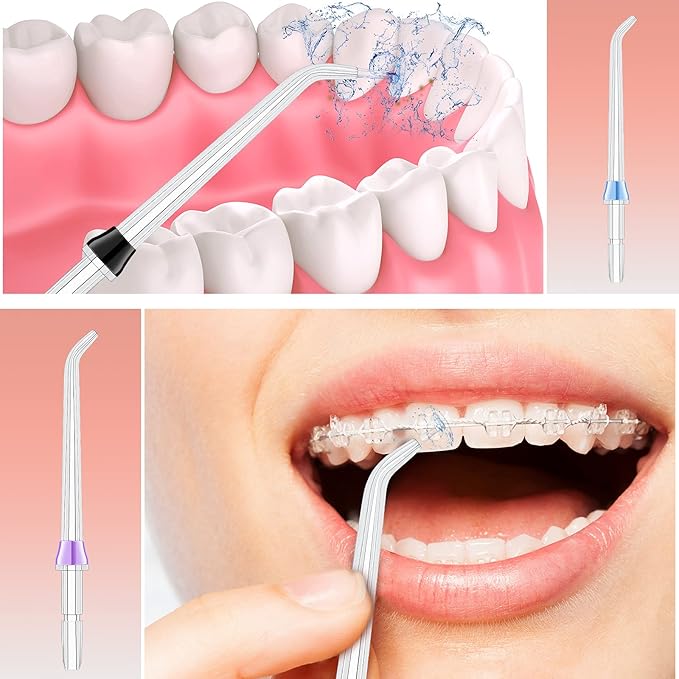 Nuanchu 8 Pieces Compatible with Waterpik Replacement Flossers Replacement Tips, Classic Jet Tips Flosser Refill Heads Replacement Heads for Water Toothpick (Classic Jet Tips)