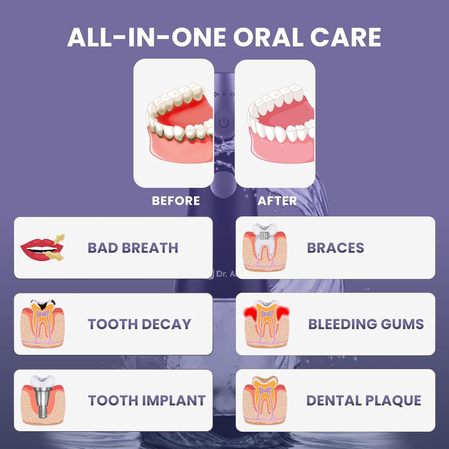 Dr. Aid Dental Water Flosser – Portable Oral Irrigator – 11Oz Tank, Water Filter, 5 Tips, Magnetic Charger – IPX8 Waterproof Cordless Water Flosser, Ideal Water Flossers for Teeth, Gums, Braces, Black