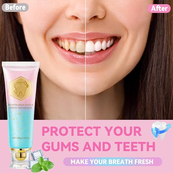 2PCS Niacinamide Whitening Toothpaste, Intensive Stain Removal & Teeth Brightening for Fresh Breath, Deep Cleaning, Enamel Safe & Gum Care (2 Pack)