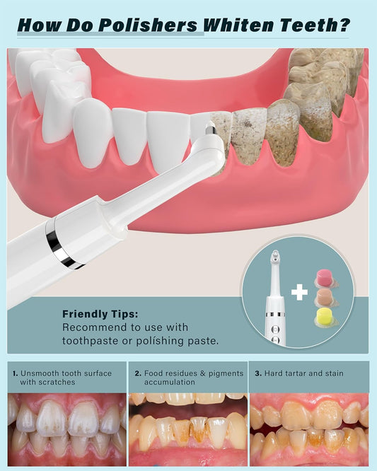 Tooth Polisher, Rechargeable Tooth Whitening Kit for Teeth Cleaning and Whitening, with 3 Tooth Polish Paste and 5 Brush Heads, LED Light, Easy to Use at-Home Personal Dental Care Kit