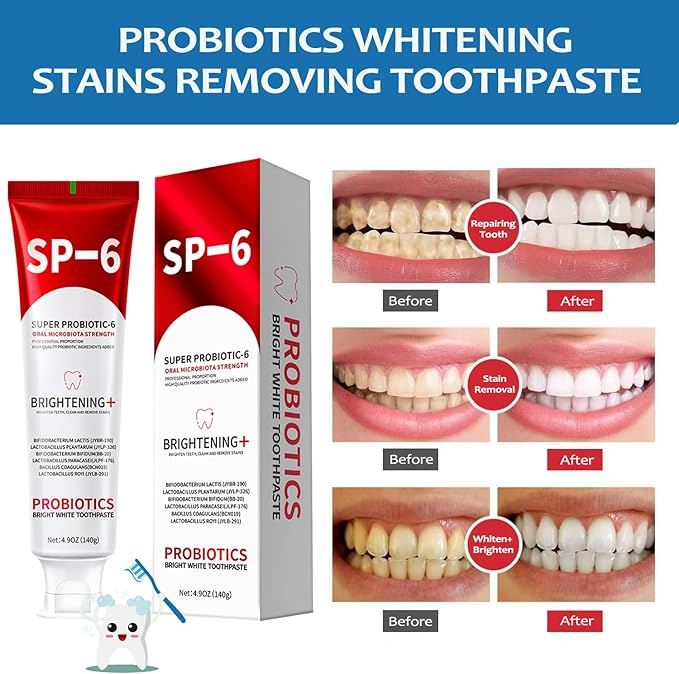 SP-6 Probiotics Whitening Toothpaste, 1 PC 6 Probiotics Enhanced Formula Brightening Toothpastes for Teeth Whitening and Gum Health, Fluoride-Free, Fresh Breath with Mint Flavor (1 PC)