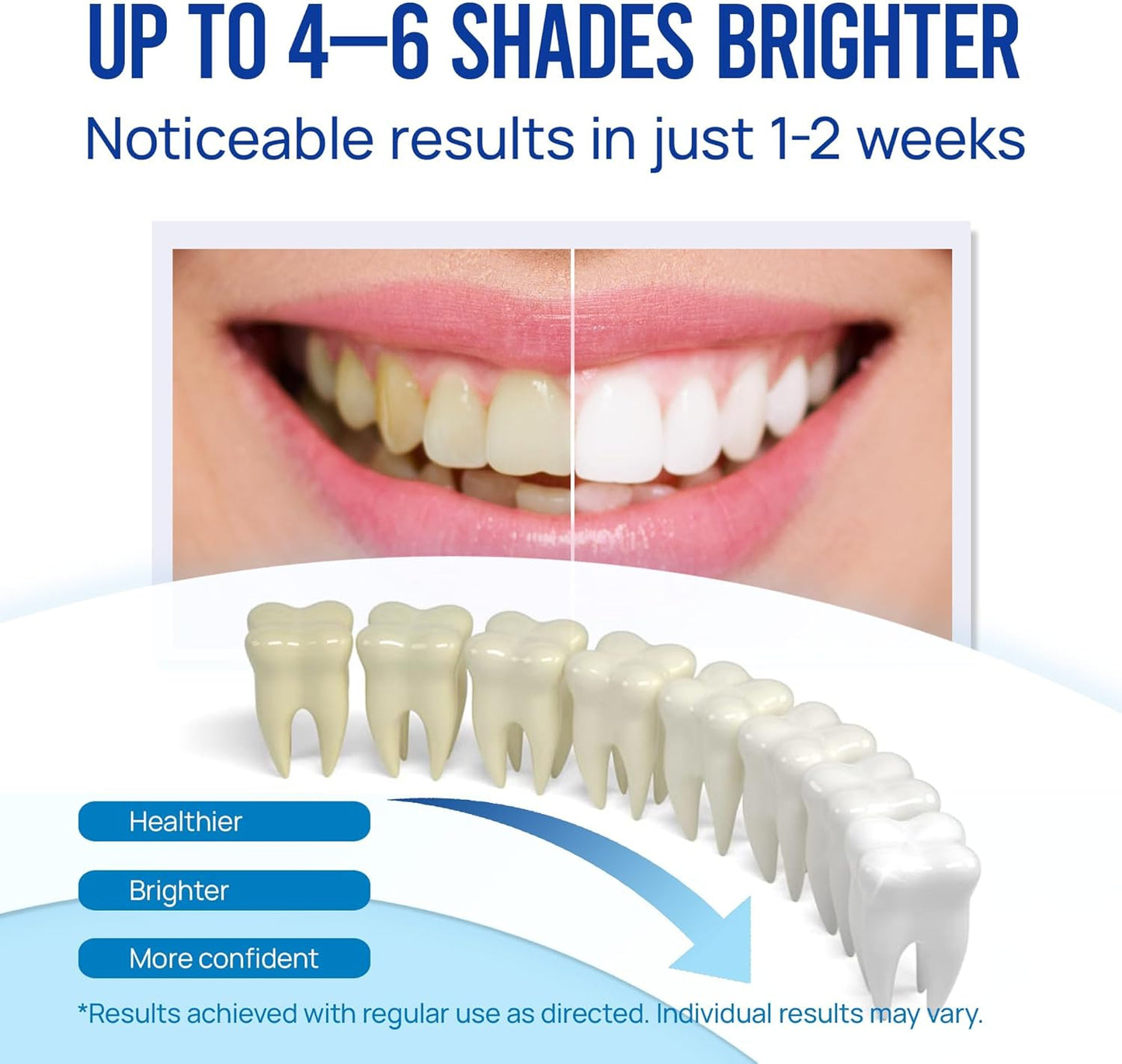 Teeth Whitening Pen Gel Kit: 35% Carbamide Peroxide Gel for Stain Removal - No Sensitivity with Remineralizing Pen for a Brighter Whiter Smile Mint (5 Pack)