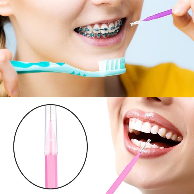 Patelai 100 Pieces Braces Brush for Cleaner Interdental Brush Toothpick Dental Tooth Flossing Head Oral Dental Hygiene Flosser Toothpick Cleaners Tooth Tool (Pink,Purple,Suitable Size)