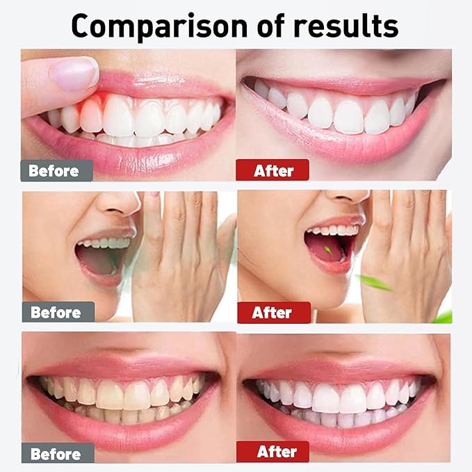 Spearmint Oil Pulling Rinse – with Organic Cold-Pressed Coconut Oil ＆ Mentha Haplocalyx Oil, Natural Mouthwash for Fresh Breath, Healthy Gums & Teeth Whitening, 8 fl oz (2)