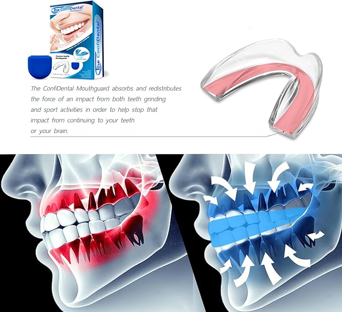 The ConfiDental - Pack of 3 Moldable Mouth Guard for Teeth Grinding Clenching Bruxism, Sport Athletic, Whitening Tray, Including 2 Regular and 1 Heavy Duty Guard (2 (LLL) Regular 1 (II) Heavy Duty)