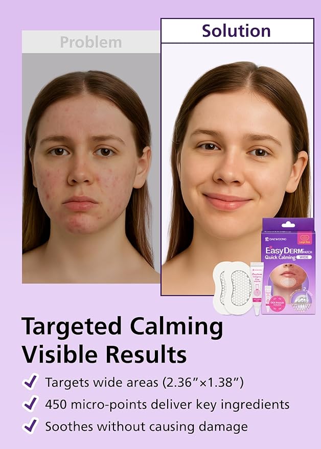EasyDerm Quick Calming Magnesium Patches WIDE – 2 Large Face Acne Patches for Breakouts, TikTok Viral Microdot, With Bonus CICA Mini Ampoule