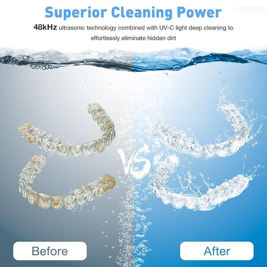 2026 Ultrasonic Retainer Cleaner Machine - 48kHz Dental Cleaning Pod for Denture, Mouth Guards, Aligner, Night Guards, Braces, Jewelry, Toothbrush, Sonic Dental Cleaner with 200ML Capacity