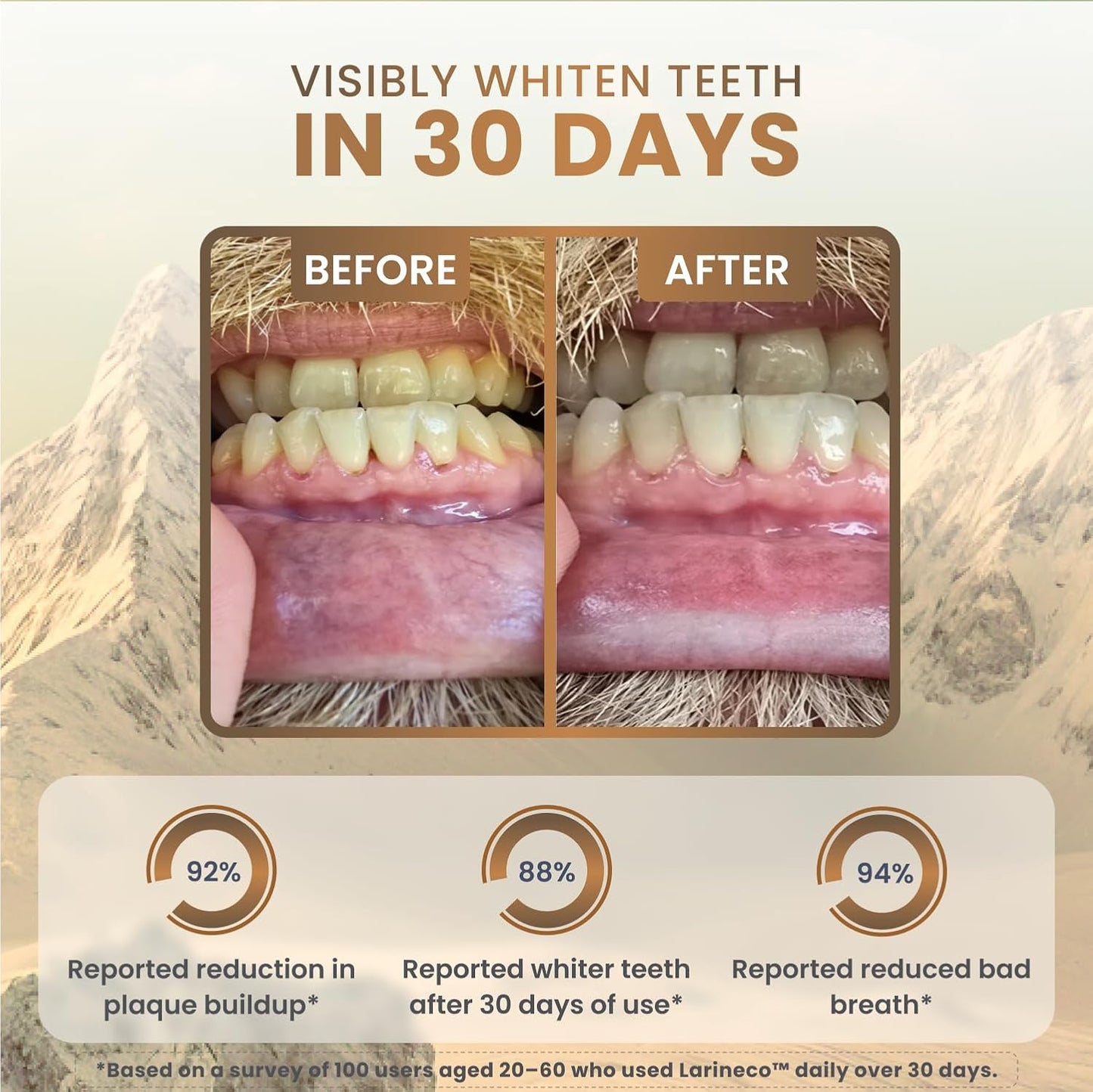 Larineco Remineralizing Gum with Nano Hydroxyapatite & Xylitol – Sugar-Free Cinnamon Xylitol Gum – Plastic-Free, Dye-Free, Aspartame-Free – Natural Base – 36 Pieces, Cinnamon