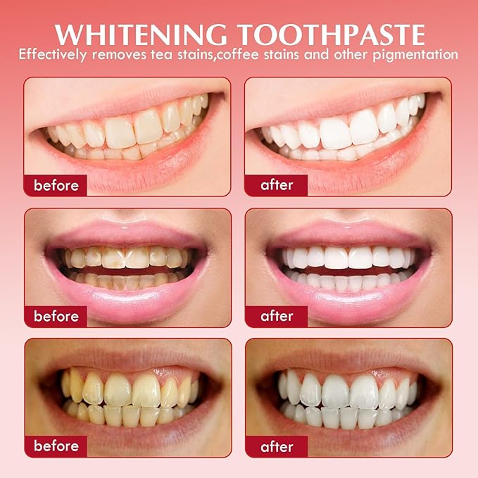 PATO Sp-6 Probiotic Whitening Toothpaste Set - Deep Cleaning Stain Removal, Teeth Protection & Fresh Breath, Mint Flavor for Enhanced Dental & Oral Health (Pack of 2)