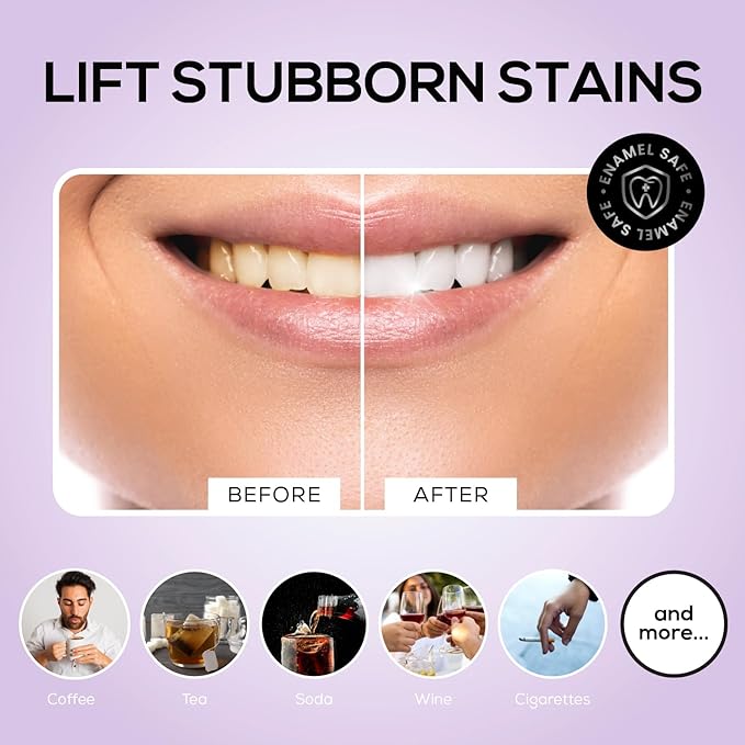 Venus Visage Activated Charcoal Toothpaste for Whitening, 3 Pack - Effective Teeth Whitening Toothpaste for Surface Stains - Peppermint Flavor (3.7 oz/105 g)