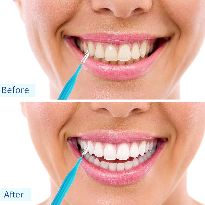 Patelai 50 Pieces Braces Brush for Cleaner Interdental Brush Between Teeth Toothpick Flosses Dental Flossing Head Oral Hygiene Tooth Cleaning Tool(Light Blue, Purple, Yellow, Gray)