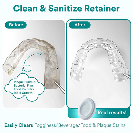 Weiss Naturals Retainer Cleaner Tablets, Invisalign Cleaner, Remove Stains, Odors & Plaque, PERSULFATE FREE Night Guard & Denture Cleaner 2-Month Supply, 60 Mint Scented Tablets