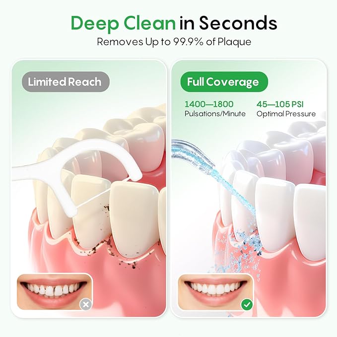 FRESKO Water Dental Flosser with Constant Pressure Technology - Portable Electric Flosser with 50-Day Battery, 10oz Tank, IPX7 Waterproof, 4 Modes & 5 Tips for Deep Oral Clean