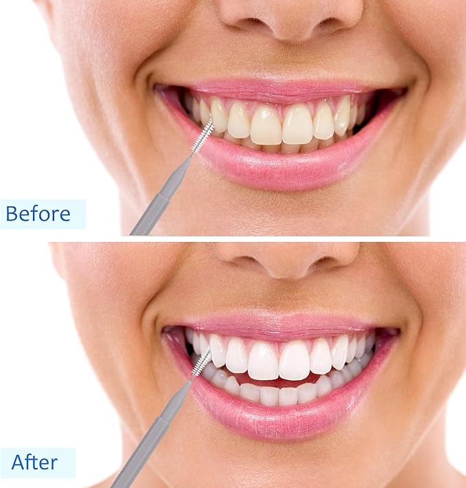 Patelai 100 Pieces Braces Brush for Cleaner Interdental Brush Toothpick Dental Tooth Flossing Head Oral Dental Hygiene Flosser Toothpick Cleaners Tooth Cleaning Tool(Blue, Grey, White,Various Sizes)