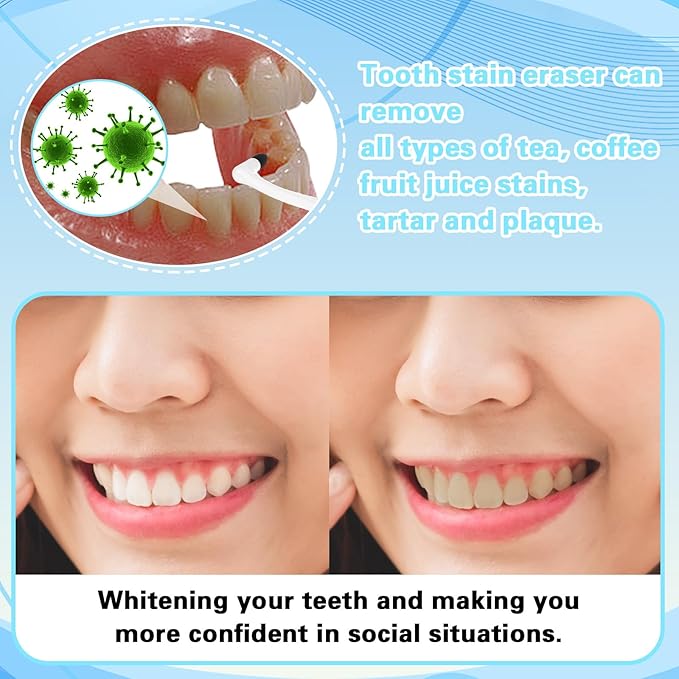 Tooth Stain Eraser Dental Tooth Stain Eraser Removers Teeth Scraper Dental Plaque Tartar Erasers Polisher Professional Dentals Picks Brush Teeth Polisher for Adult Oral Care