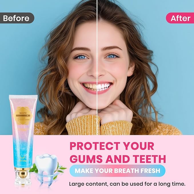 Hotlock Niacinamide Whitening Toothpaste - Brightening, Stain Removal, Freshening Breath Whitens Teeth, Protects Tooth Enamel, Freshens Breath 24 Hours 3.53oz.