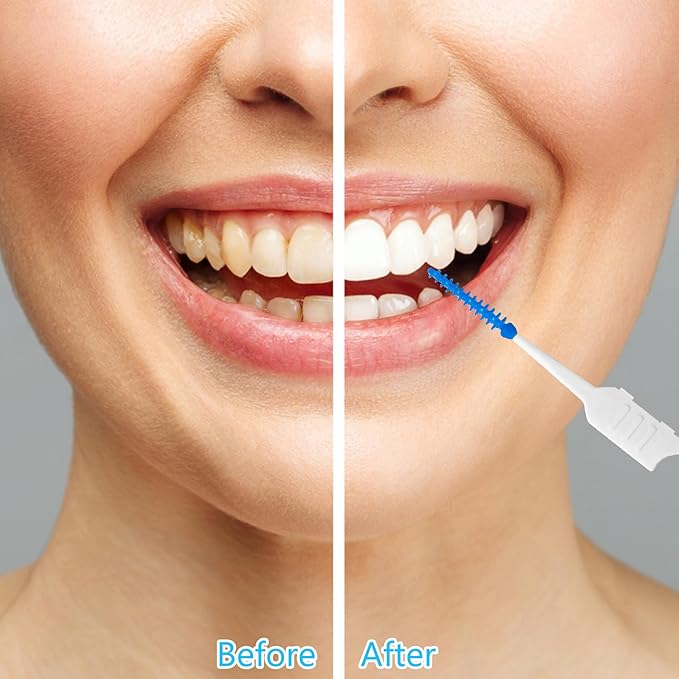 250 Pieces Dental Floss Picks, Silicone Interdental Brushes with Case Dental Brushes Dental Picks Blue Tooth Floss Picks for Teeth Cleaning(Blue)