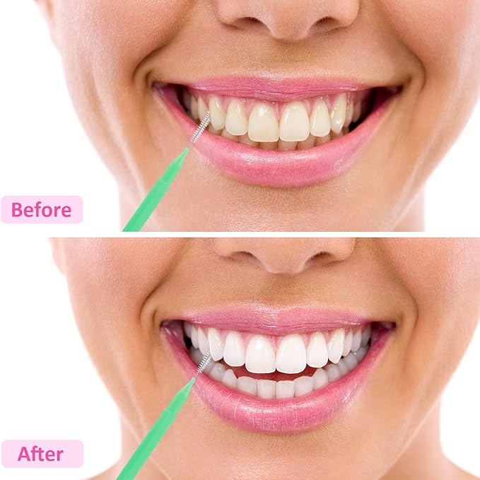 Patelai 100 Pieces Braces Brush for Cleaner Interdental Brush Toothpick Dental Tooth Flossing Head Oral Dental Hygiene Flosser Toothpick Cleaners Tooth Tool (Green, Orange, Blue,Various Sizes)