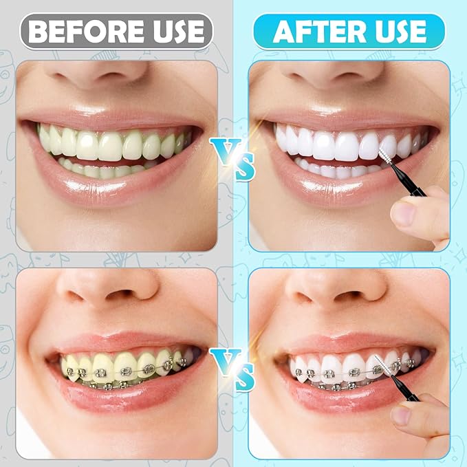 Modacraft 120Pcs Interdental Brushes, Deep Cleaning Braces Flossers for Braces Orthodontic with Soft Bristles 360° Bendable Floss Heads Dental Brushes Between Teeth Gum Braces Oral Cleaning Tool Kit