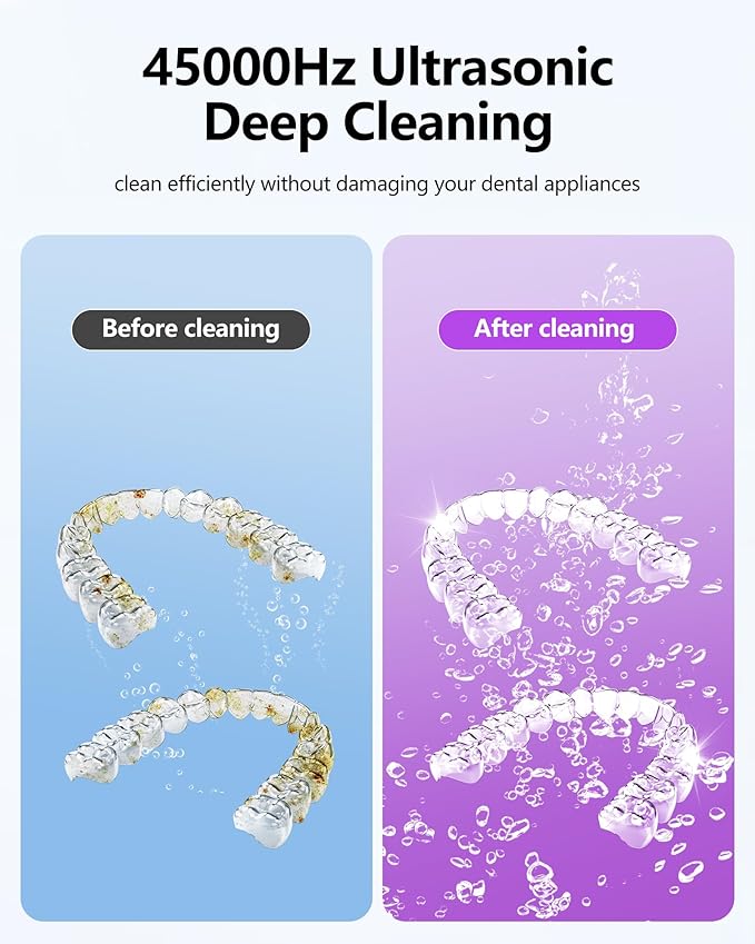 Ultrasonic Retainer Cleaner Machine 45kHz Dental Ultrasonic Retainer Cleaner for Dentures & Mouth Guard Cleaning for Whitening Trays, Toothbrush Heads, Diamond, Jewelry