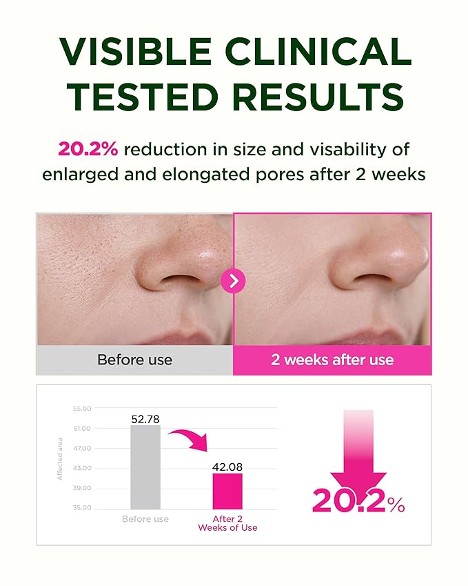 CKD Retino Collagen Boosting Hydrogel Face Mask (1ea) - Korean Overnight Jelly Mask for Glass Skin, Deep Moisturizing, and Pore Minimizing with Retinal & Low Molecular Collagen. Korean Skin Care