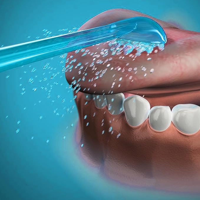 Replacement Tips for Waterpik Water Flosser Classic Jet Tips Waterpik' Replacement Parts (8 Tips)