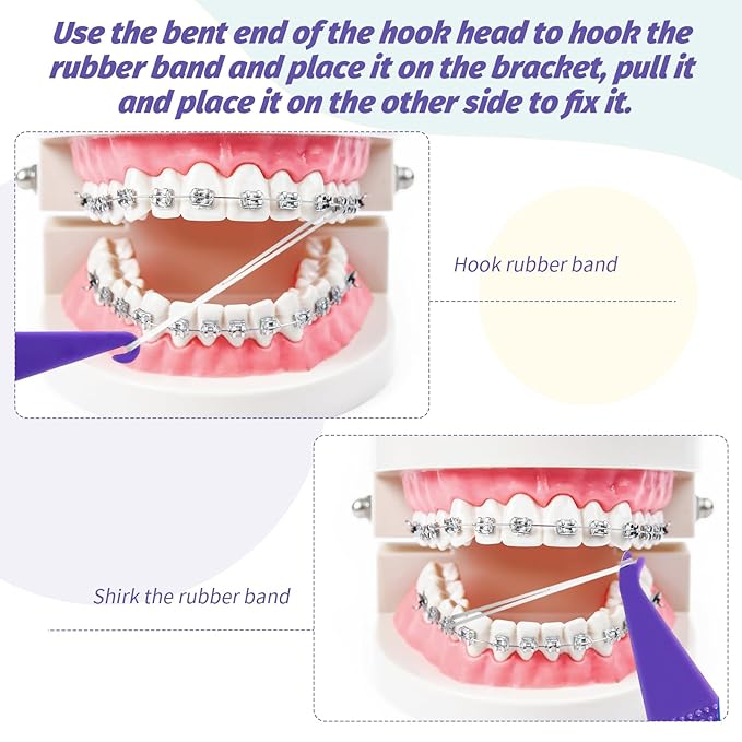 160PCS Colorful Braces Rubber Band Tool, Disposable Plastic Orthodontic Rubber Bands Tool Dental Elastic Rubber Bands Placers for Braces,Braces Removal KitBraces Rubber Bands Tool Braces Tools