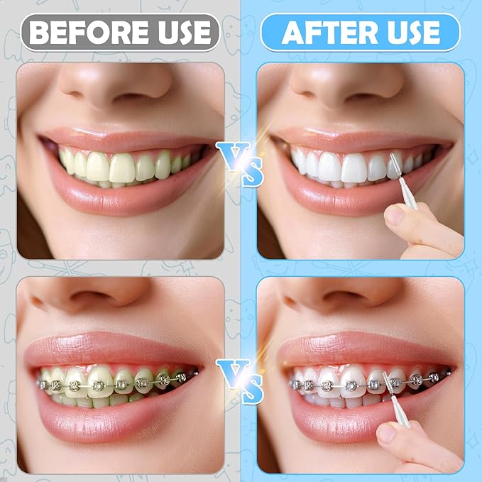 120Pcs Interdental Brushes, 360° Bendable Soft Bristles Braces Flossers Dental Brushes Between Teeth Gum Interdental Brushes for Gum Braces Oral Teeth Cleaning Tool (White)