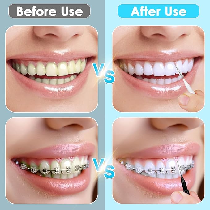 270Pcs Interdental Brush, 220Pcs Soft Dental Picks & 50Pcs Braces Brush for Teeth, Bendable Braces Flossers Heads Interdental Brushes Between Teeth Oral Tooth Braces Cleaner (Black & White)