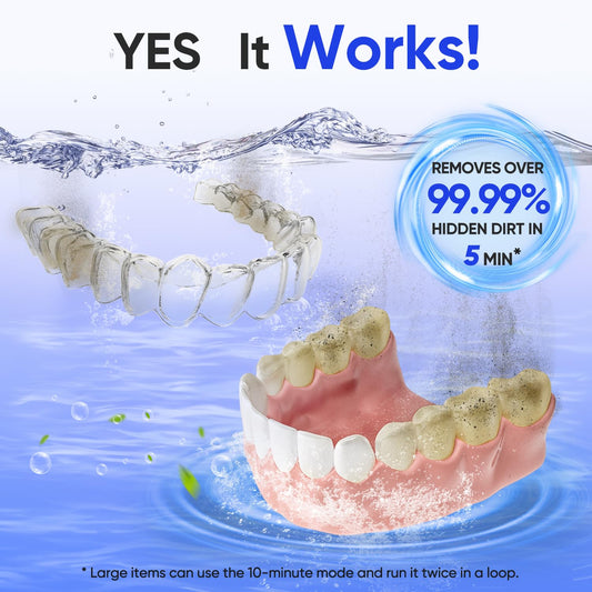 MySmile Ultrasonic Retainer Cleaner- 45kHz Denture Cleaner Machine with 200ML Capacity for Aligner, Mouth Guard, Braces, Portable Dental Cleaning Pod with 2 Mode Digital Timer for Home, Travel (WHITE)