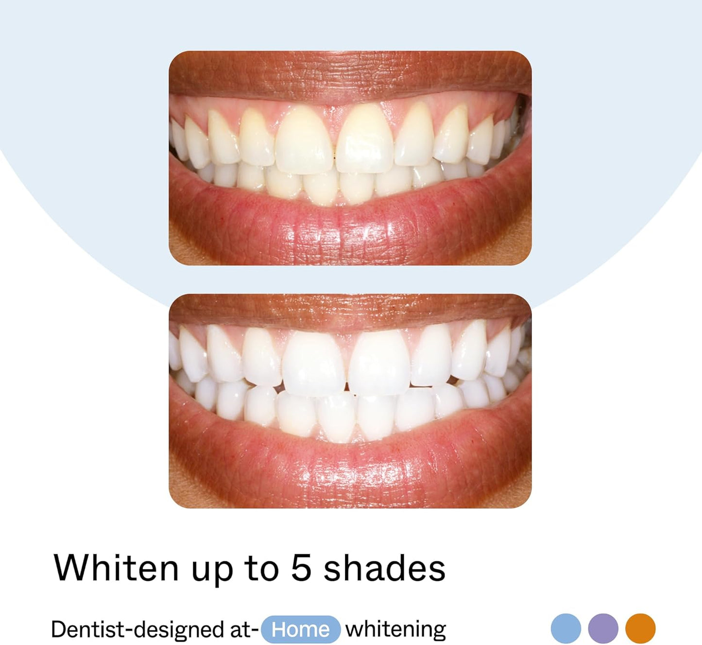 Opalescence GO Home Advanced Teeth Whitening Trays 15% (4 Treatments) Hydrogen Peroxide PF - Whitening Prefilled Kit - Developed by Leaders in Professional Whitening 6006-T