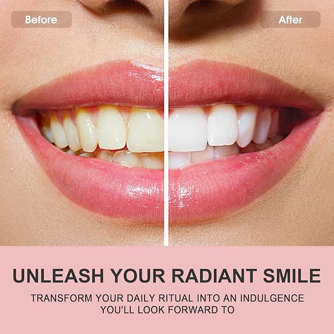 Hotluck Niacinamide Whitening Toothpaste - Brightening, Stain Removal, Freshening Breath - Deep Gentle Cleaning Tooth Paste, Boosting Gum Health, Mint & Peach 3.53oz