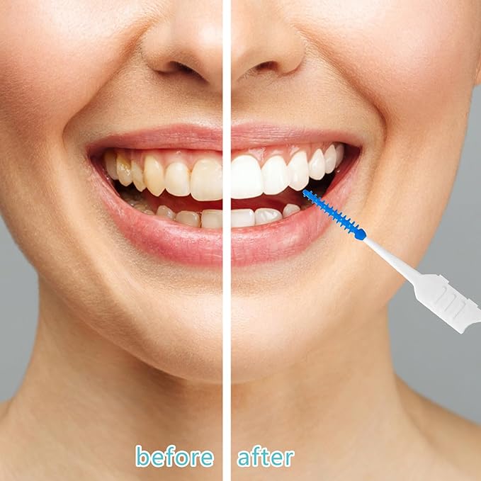 250 Pieces Dental Floss Picks, Silicone Interdental Brushes with Case Dental Brushes Dental Picks Blue Tooth Floss Picks for Teeth Cleaning(Blue,Green)