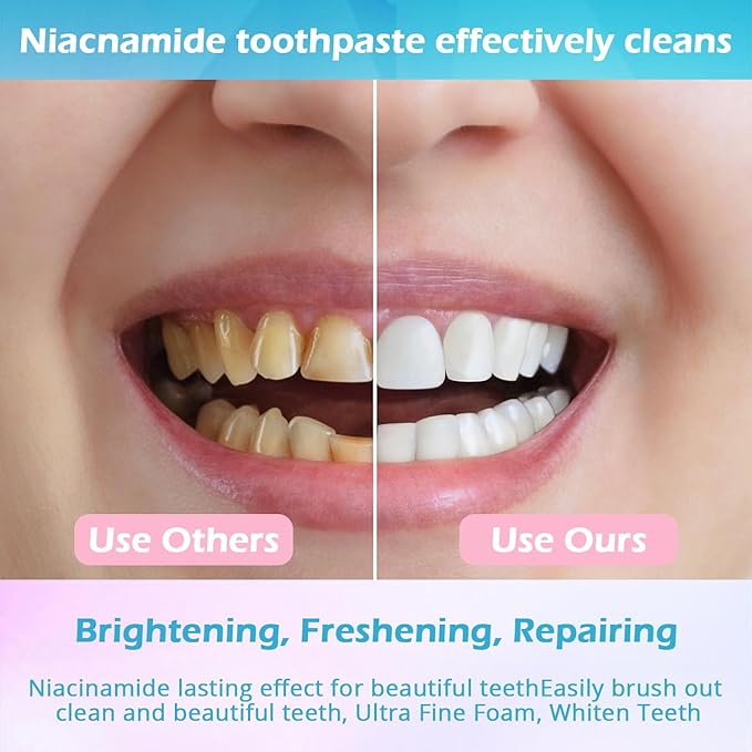 Niacinamide Whitening Toothpaste, Niacinamide Toothpaste Intensive Whitens Teeth, Protects Enamel, Removes Stains & Refreshes Breath, Daily Oral Care at Home Mint Flavor (1 Pack)-YanxiananYagao